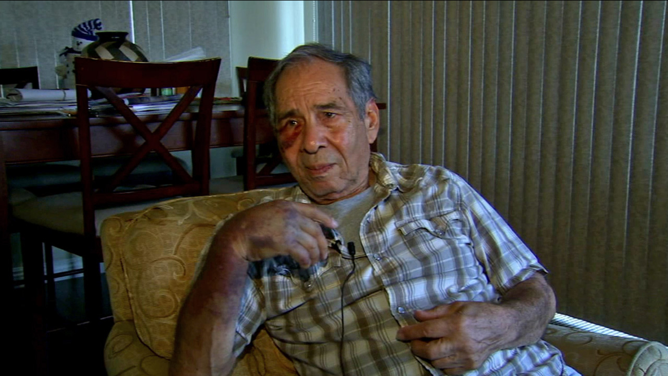 Raul Fonseca, 79, was badly beaten and knocked unconscious by a suspect while he was trying to use a Bank of America ATM in Temple City Saturday, Feb. 14, 2015.
