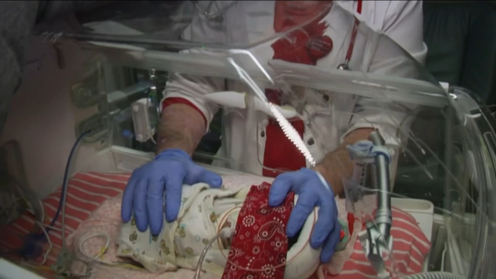 Health Watch: Babyleo helps the tiniest patients - ABC30 Fresno