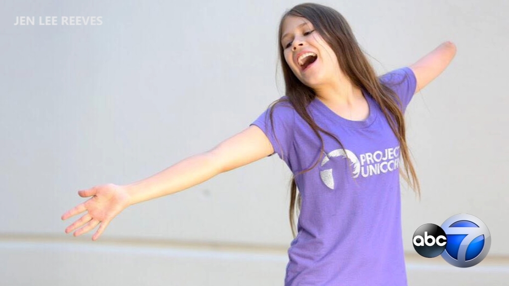 Project Unicorn: The glitter shooting prosthetic arm