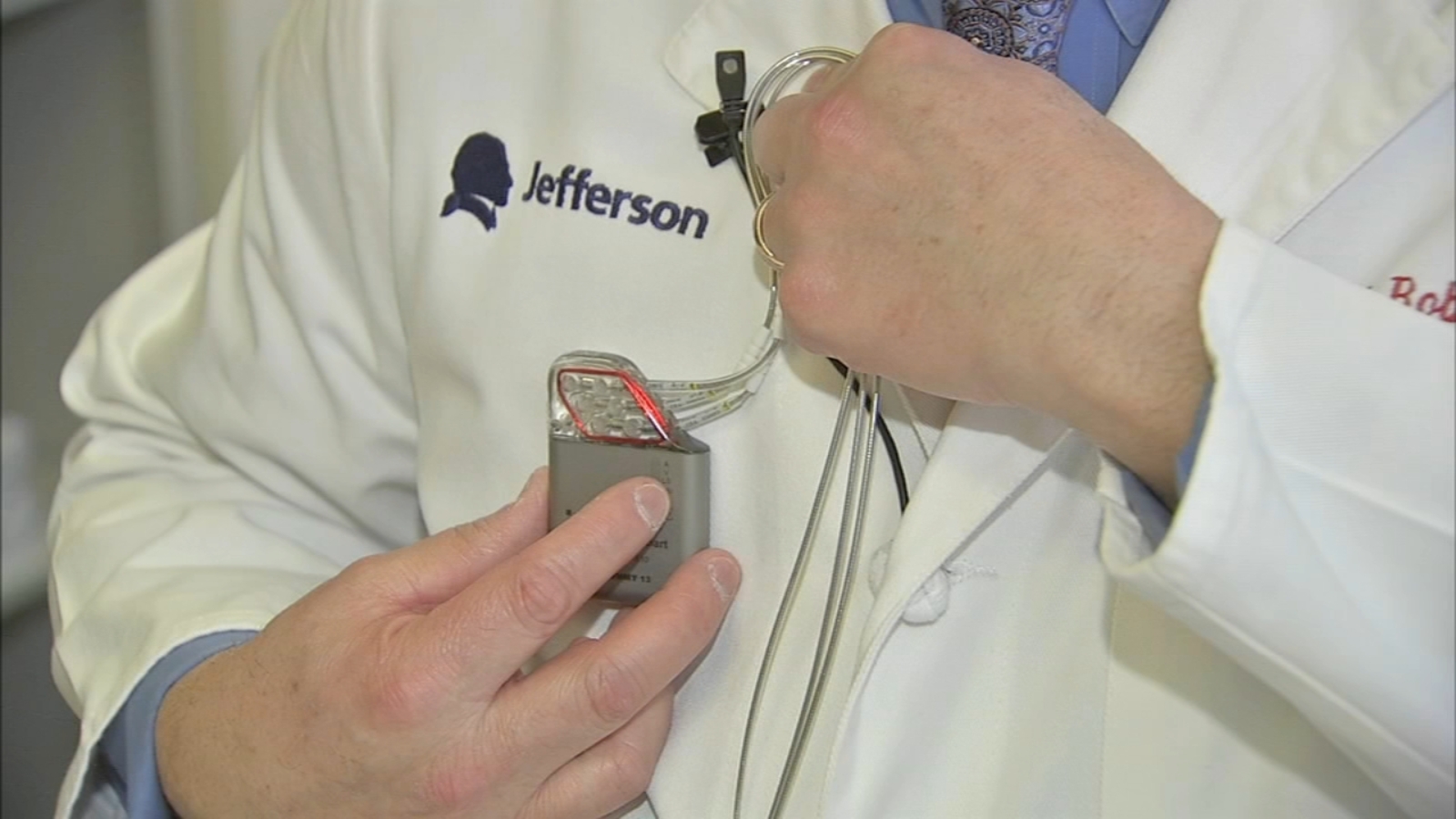 JustOK'd device for heart failure patients helps local woman 6abc