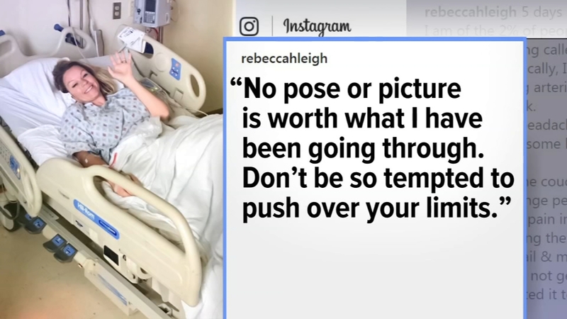 Yoga Stroke Woman Tears Neck Artery Suffers Stroke After Extreme Yoga Pose Abc30 Fresno