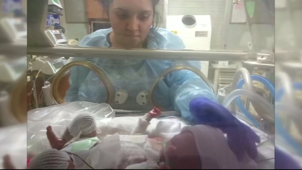 Mother can finally kiss baby born without skin