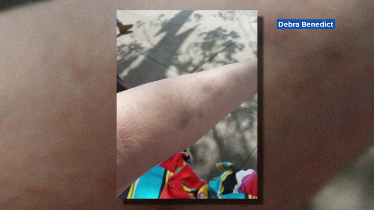 EXCLUSIVE: SFPD tell woman to 'take a different route' after being attacked by homeless woman