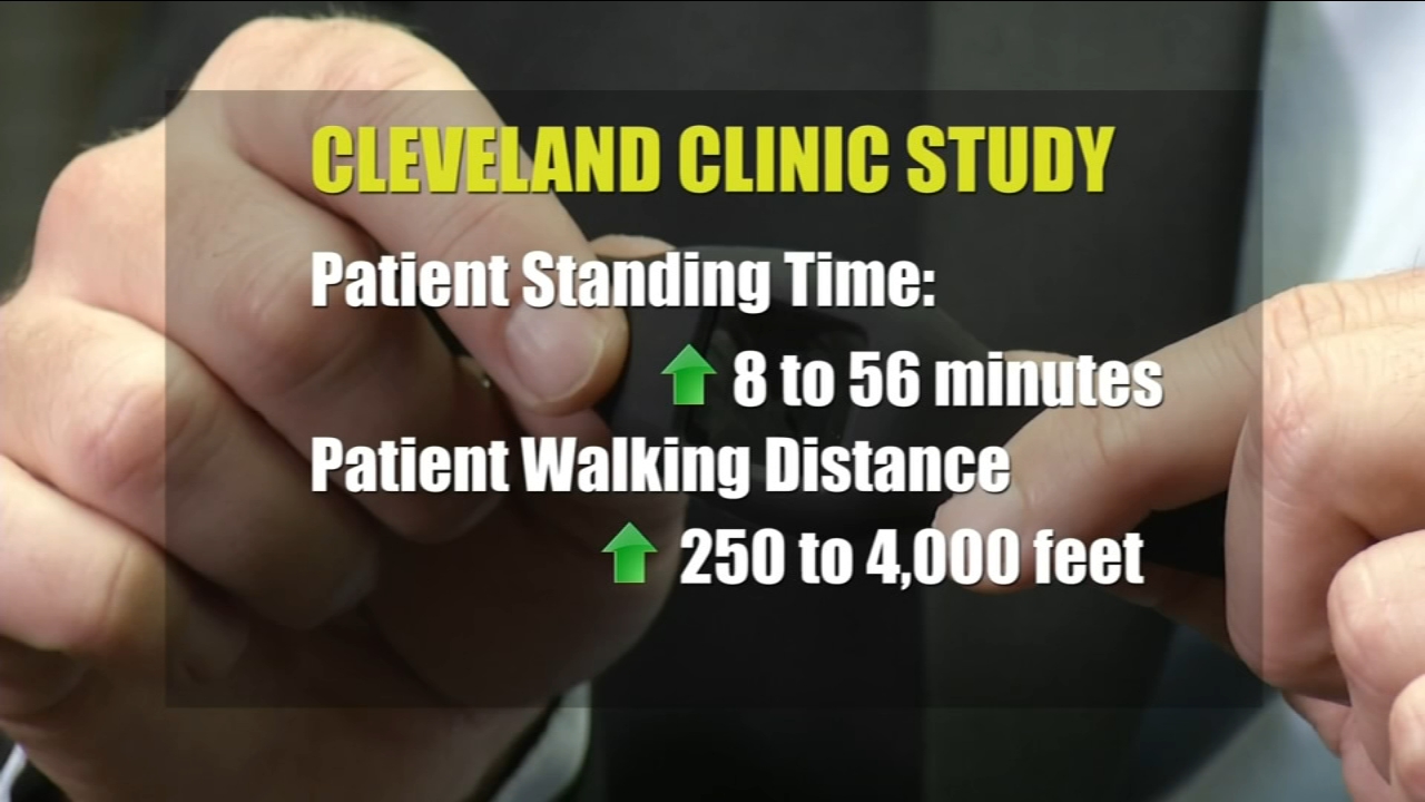 FitBits can help fight lumbar spinal stenosis