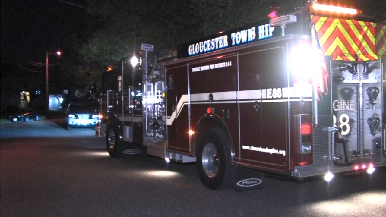 Girl burned after fall into fire pit