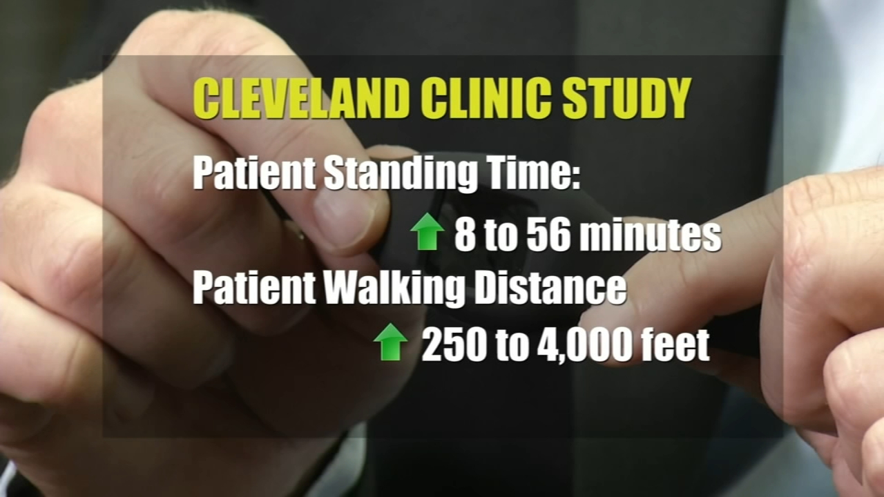 New clinical trial using fitness trackers to treat lumbar spinal stenosis