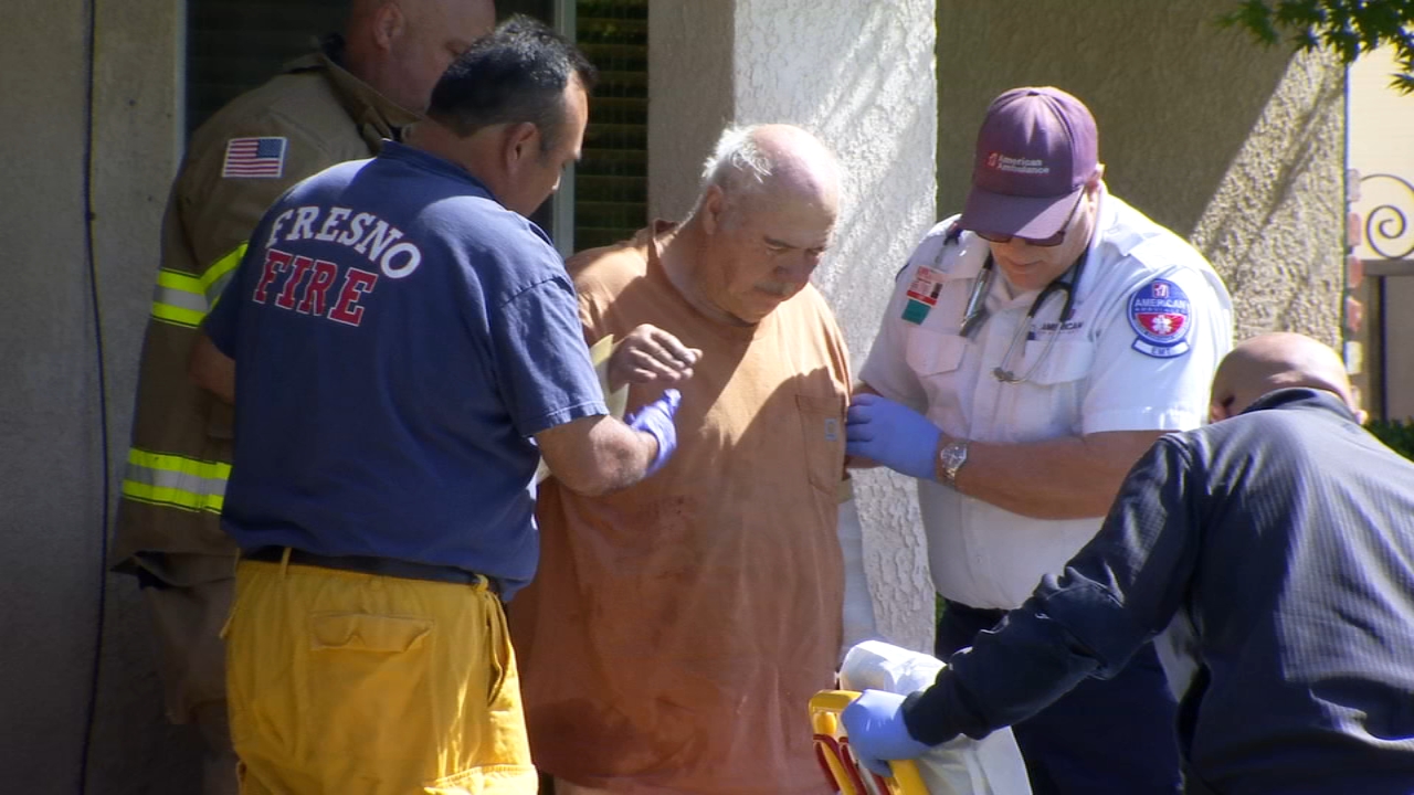 Man severely burned while working on car in East Central Fresno