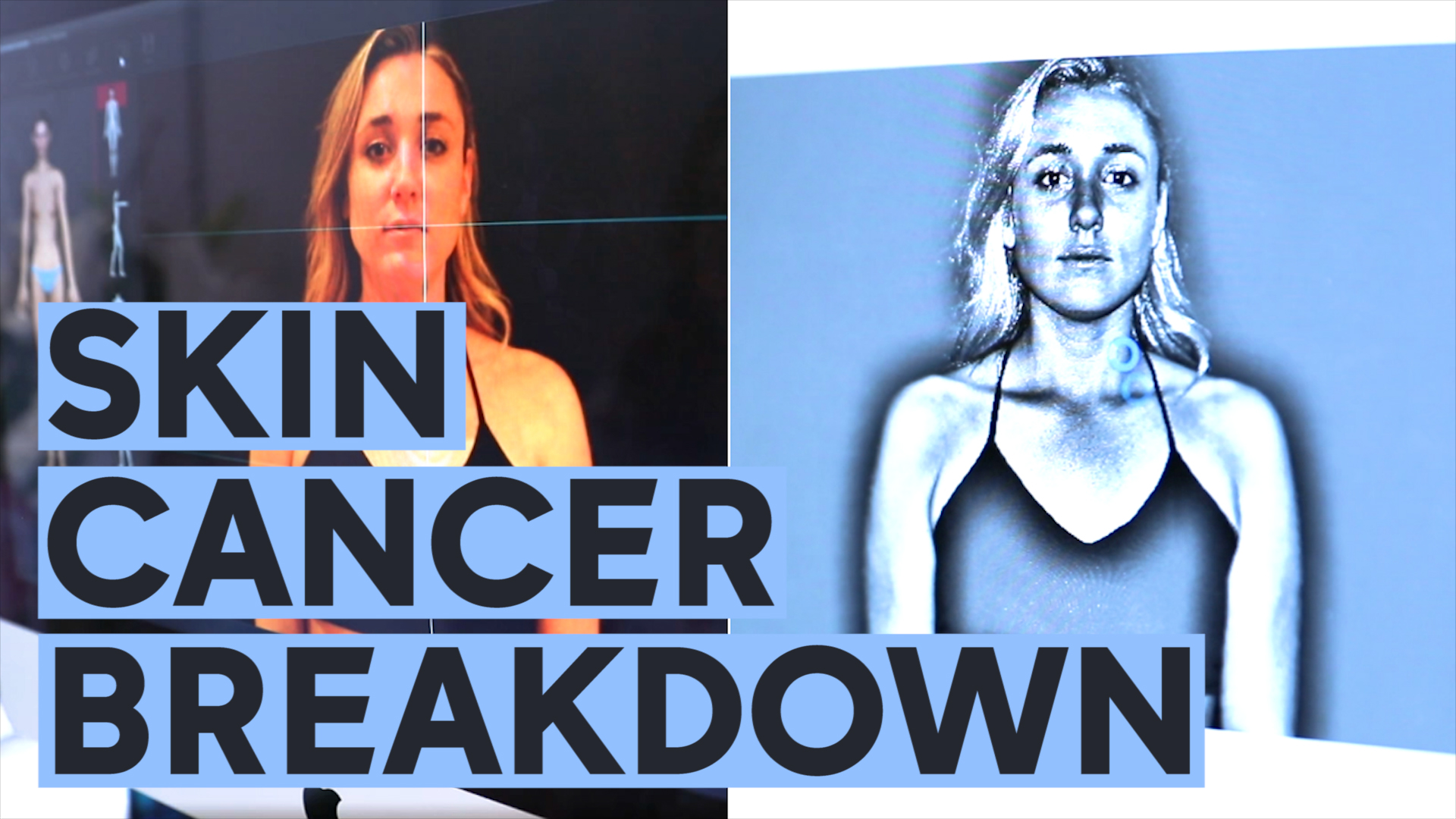 052419-wabc-original-glam-lab-moles-skin-cancer-playlist