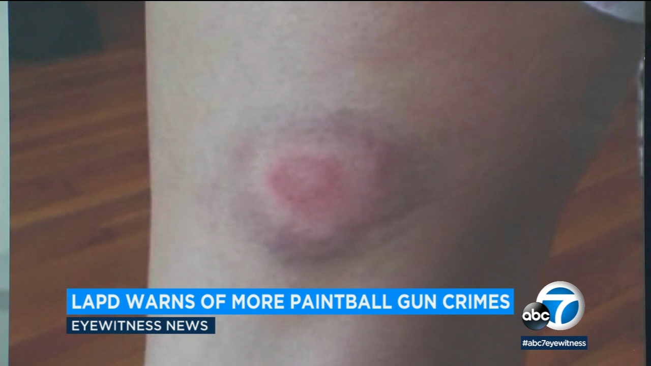Paintball gun assaults on the rise in L.A. with 28 people shot