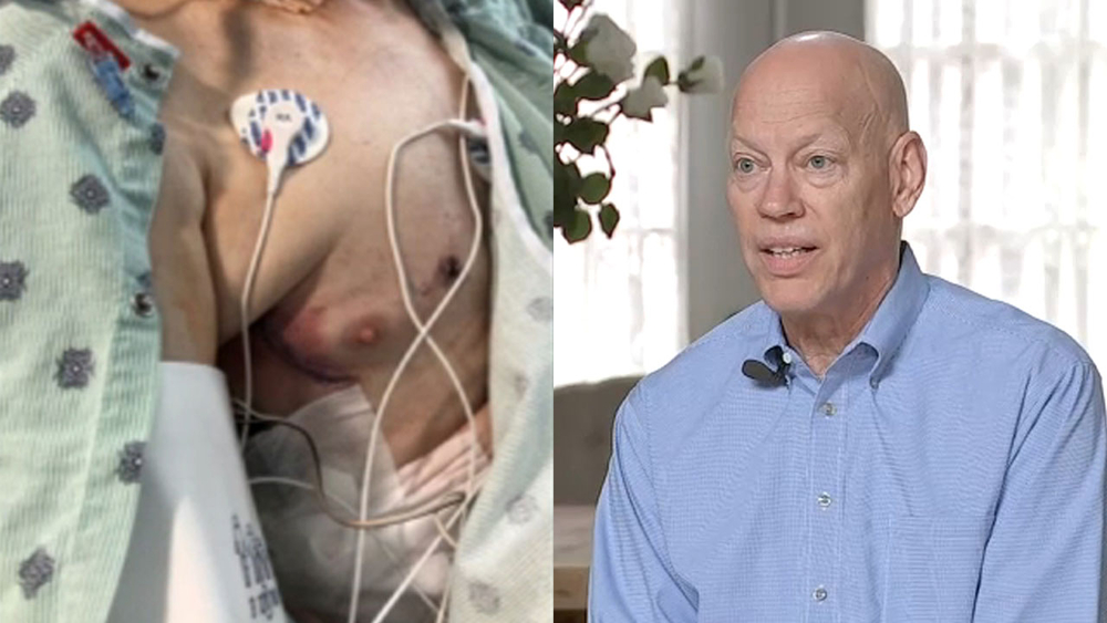 Father of 10 gets heart operation with little invasiveness