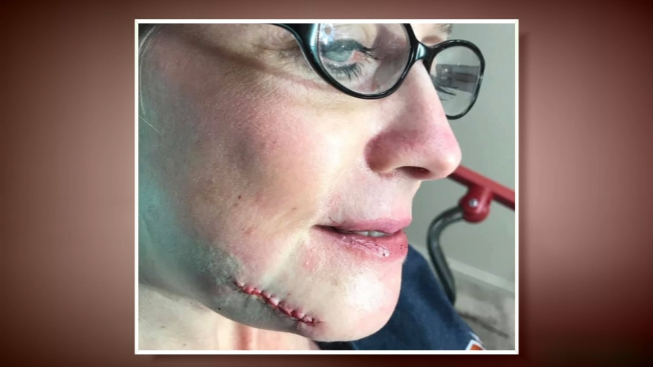 Foul ball leaves woman with fractured jaw at Minute Maid Park