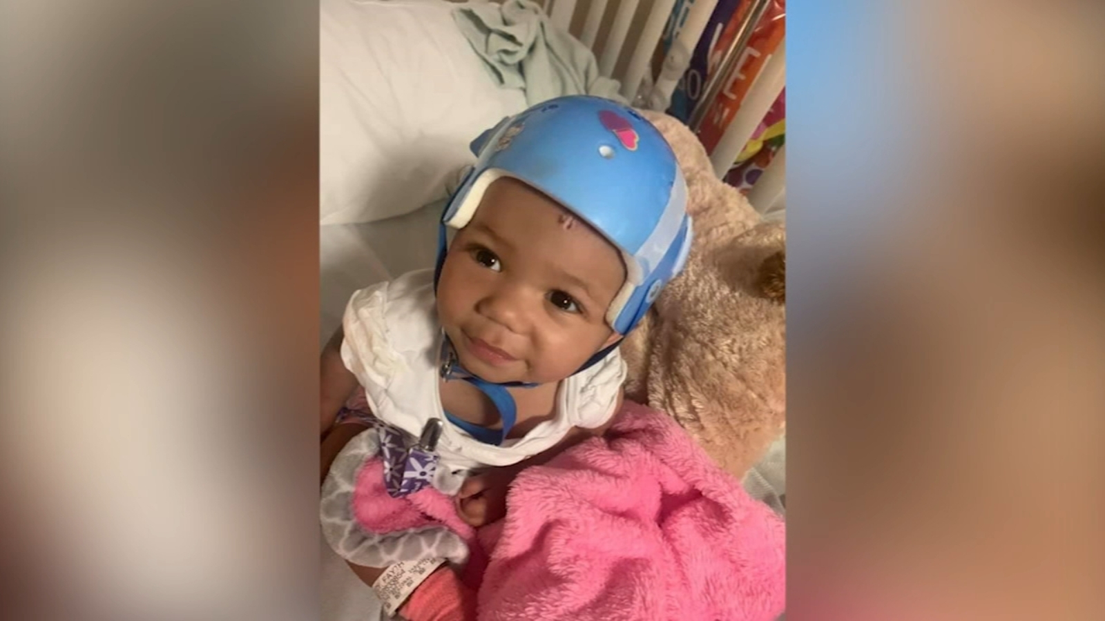 10-month-old-shot-in-the-head-expected-to-make-a-significant-recovery