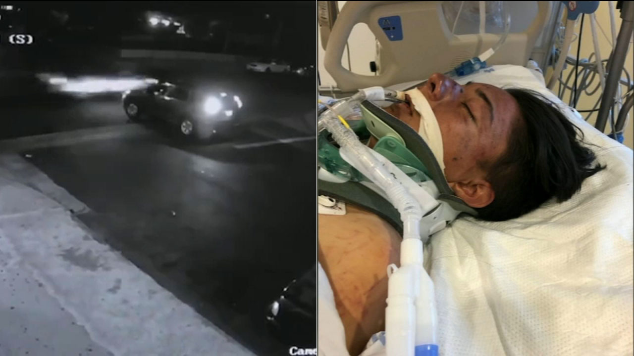 Video released in search for driver who injured teen in South LA
