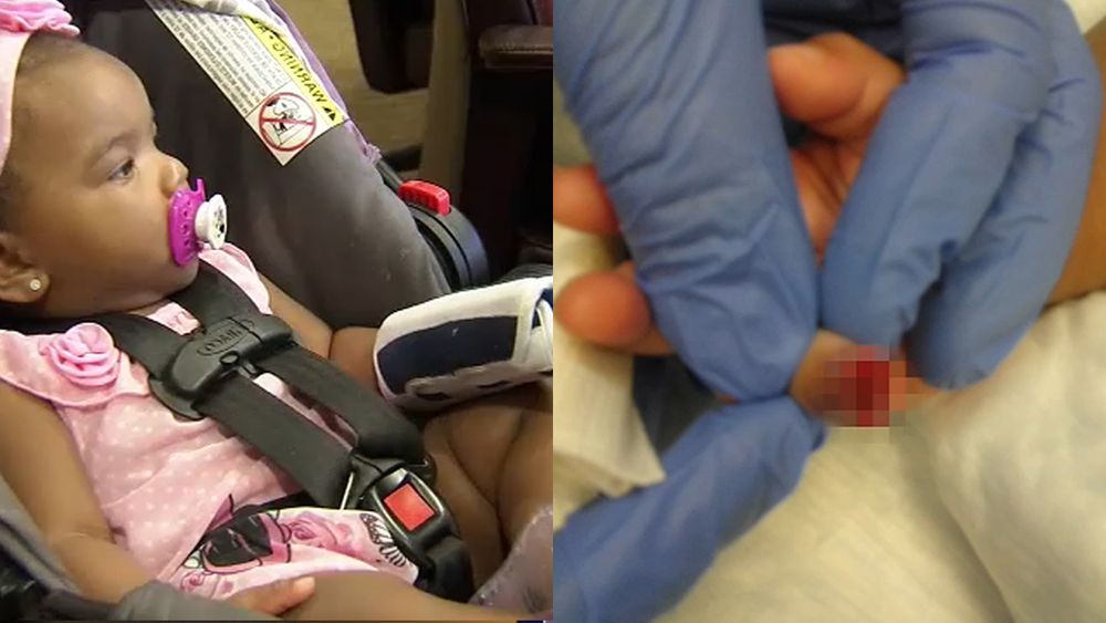 Part of baby's finger severed during day care incident: Lawsuit