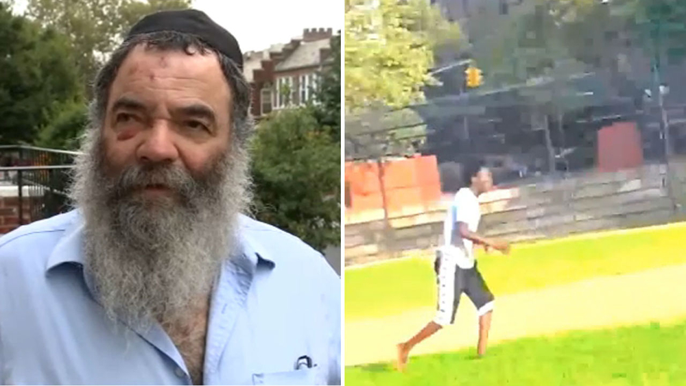 Rabbi hit with rock in Brooklyn speaks out about the violent attack