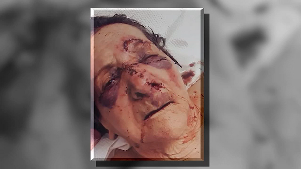 86-year-old woman assaulted at New Jersey nursing home, son says