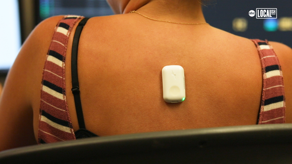 Can this device really fix your posture?