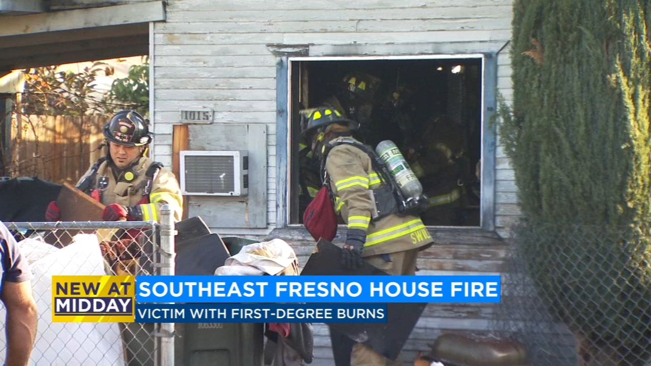 1 hospitalized for burns after southeast Fresno house fire