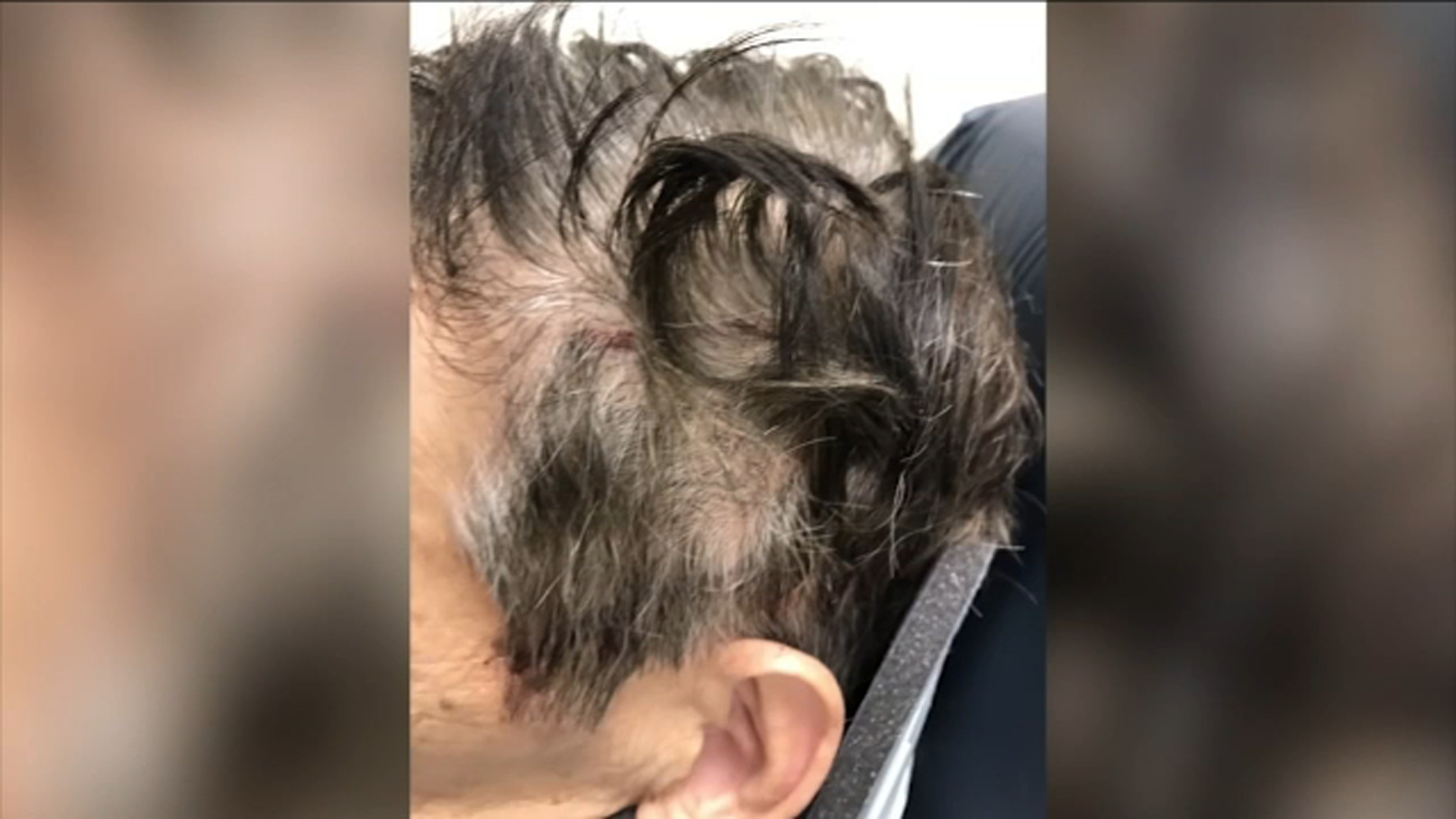 62-year-old recovering from violent, unprovoked subway attack