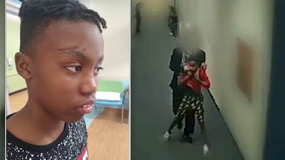 5th grader injured after teacher allegedly bashed head open
