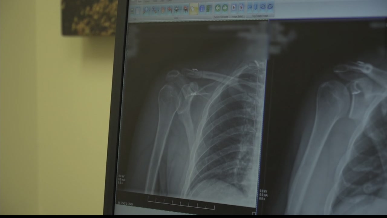 Washington Hospital is your source for total orthopedic care