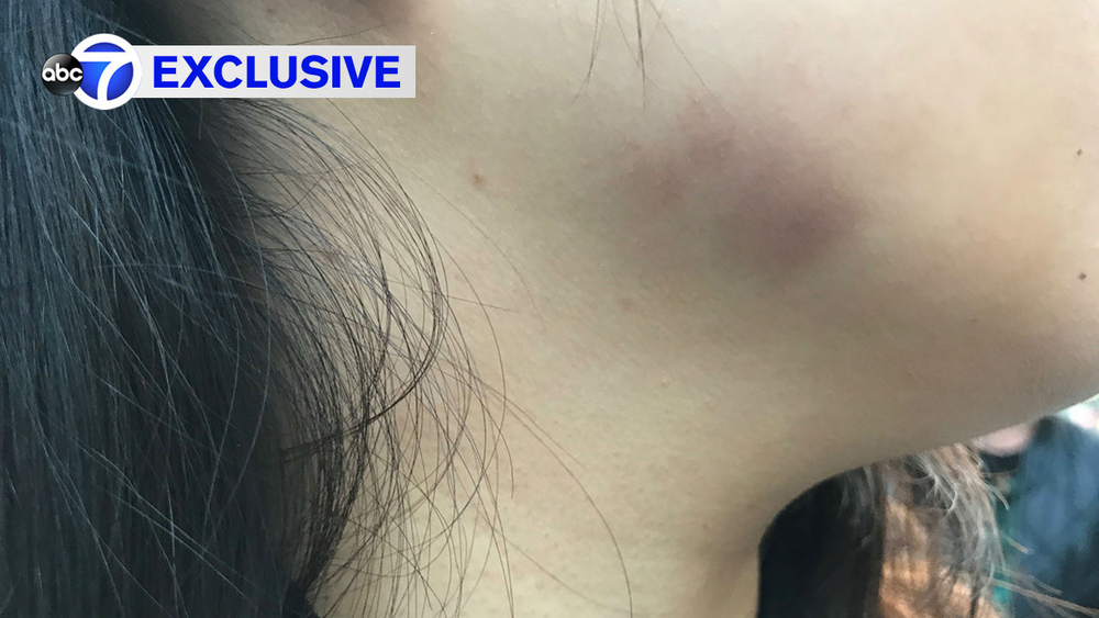 'Where's your (expletive) mask?': Asian woman attacked in Manhattan hate crime