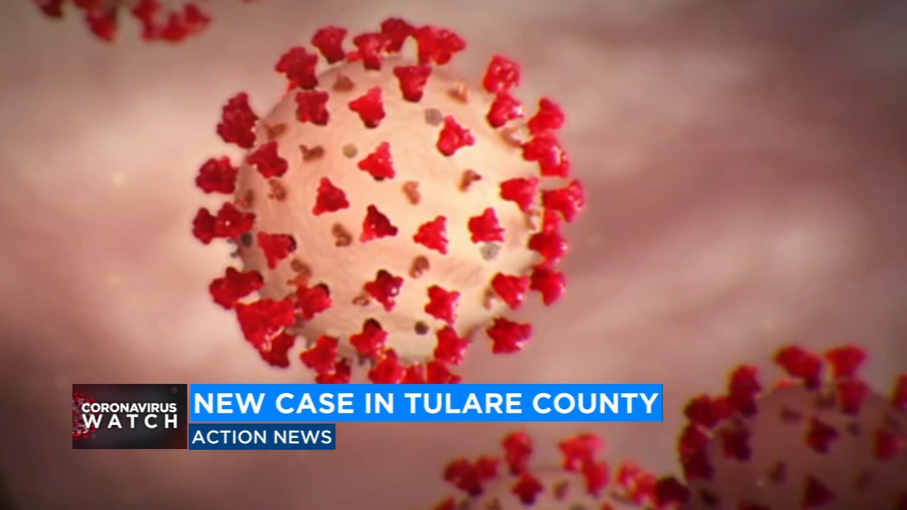 Health officials confirm third COVID-19 case in Tulare County