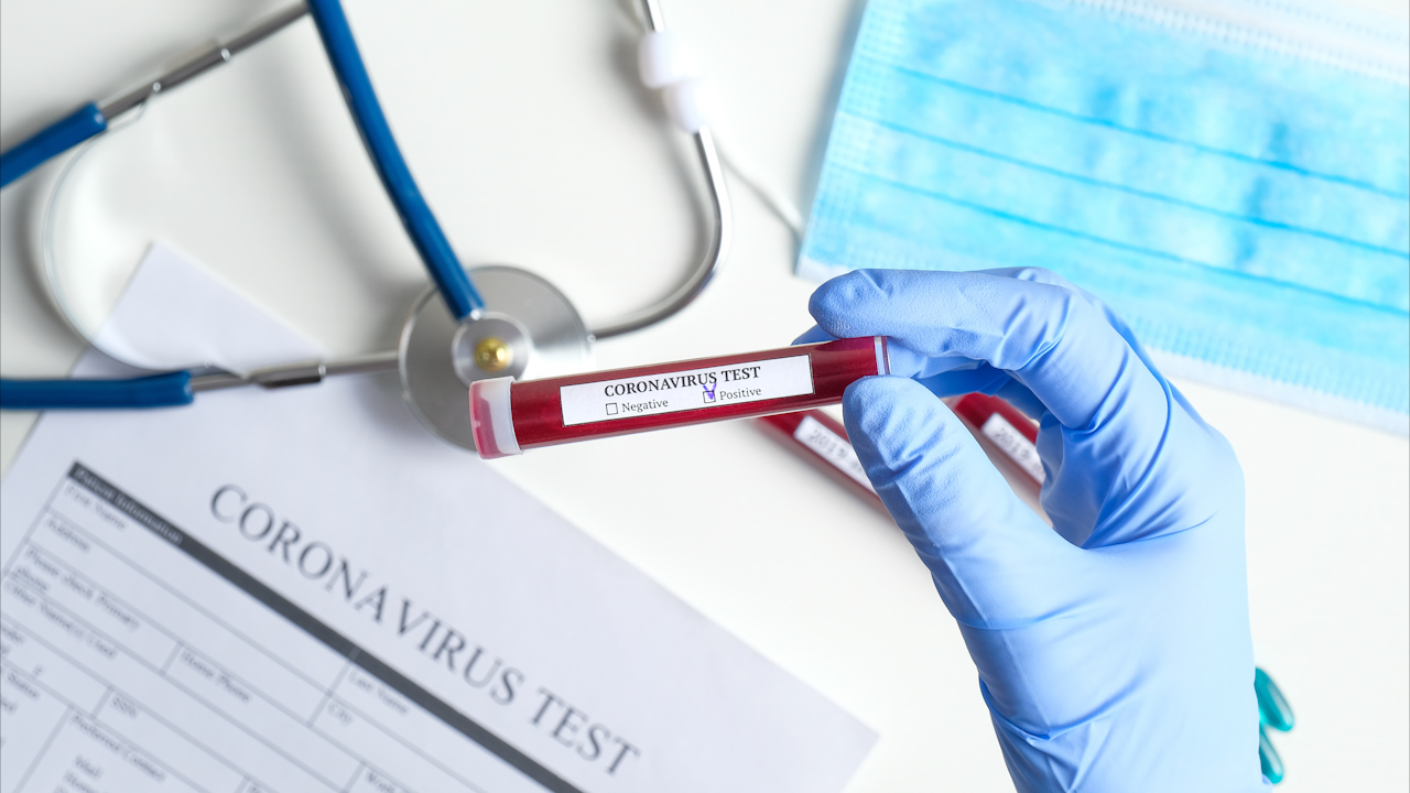 Dr. Peter Hotez says COVID-19 could stick around for years 