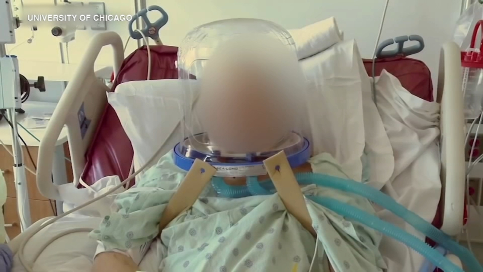 Coronavirus Chicago University of Chicago hospital using helmets