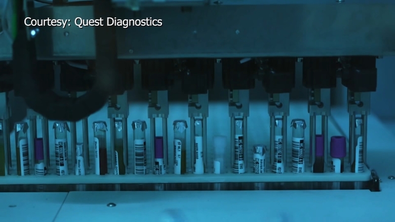 High Demand For Antibody Tests Coming From Those Who Think They