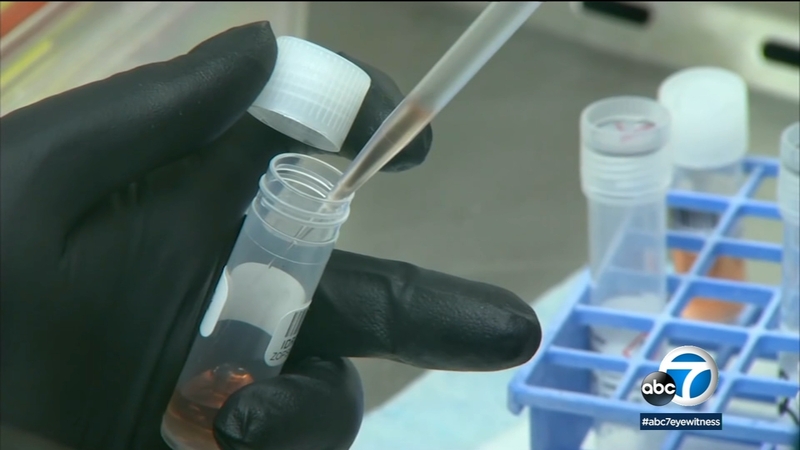 San Bernardino Lifestream Blood Bank Collecting Plasma Donations From Recovered Covid 19 Patients Abc7 Los Angeles