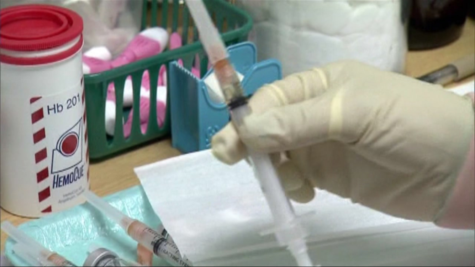 Ucsf Doctor Warns Measles Is Way More Infectious Than Covid Concerned Children Aren T Being Vaccinated During Pandemic Abc7 San Francisco