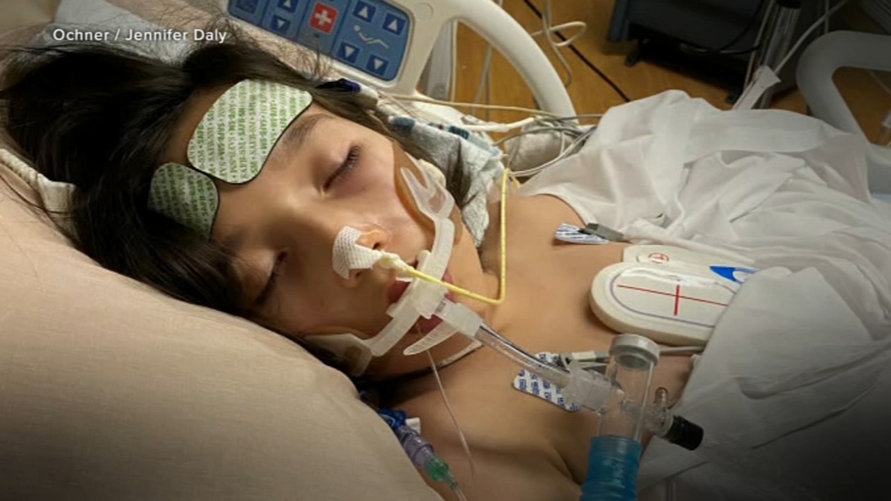 CDC alerting doctors to look for rare illness in kids possibly linked to COVID-19