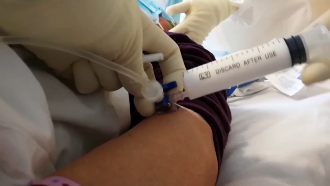 First look at nursing homes with worst COVID-19 outbreak