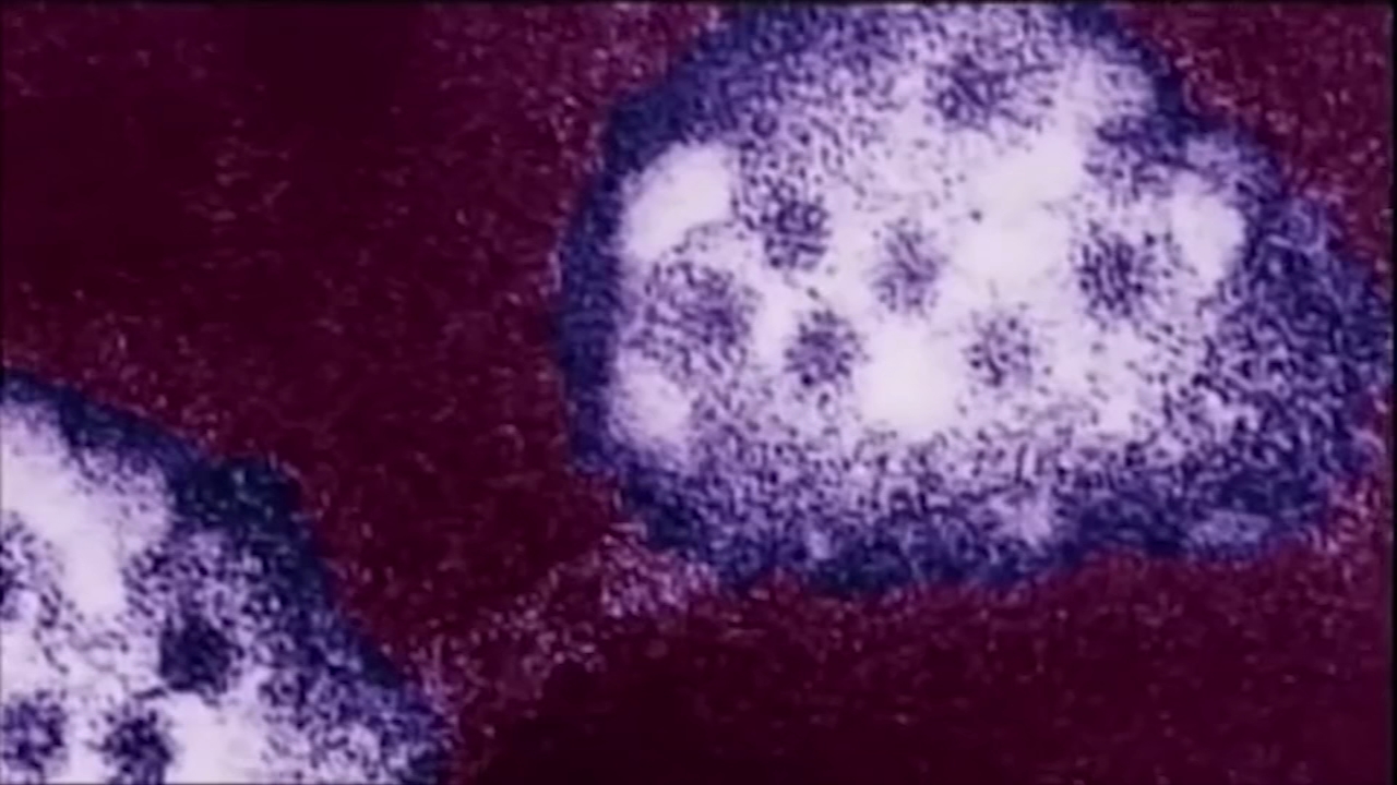 Texas reports highest one-day total of new coronavirus cases