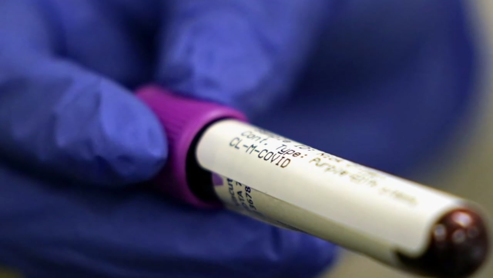 COVID-19 testing demands reach 'unprecedented levels'