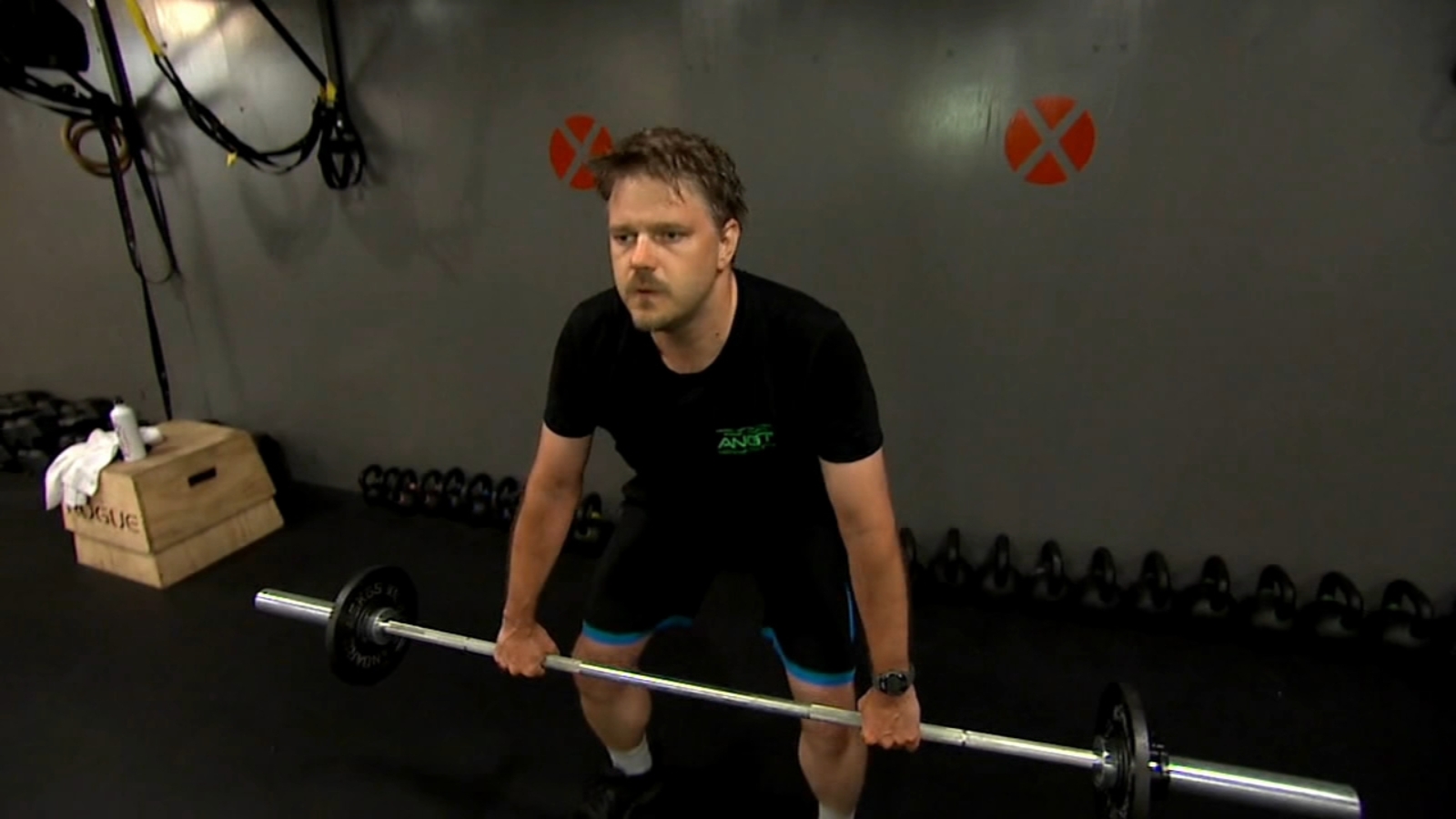 Moves in Medicine Understanding hernias, when it's time for surgery and what recovery is like