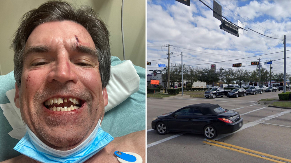 Father suffers broken jaw, ribs in bike hit-and-run accident