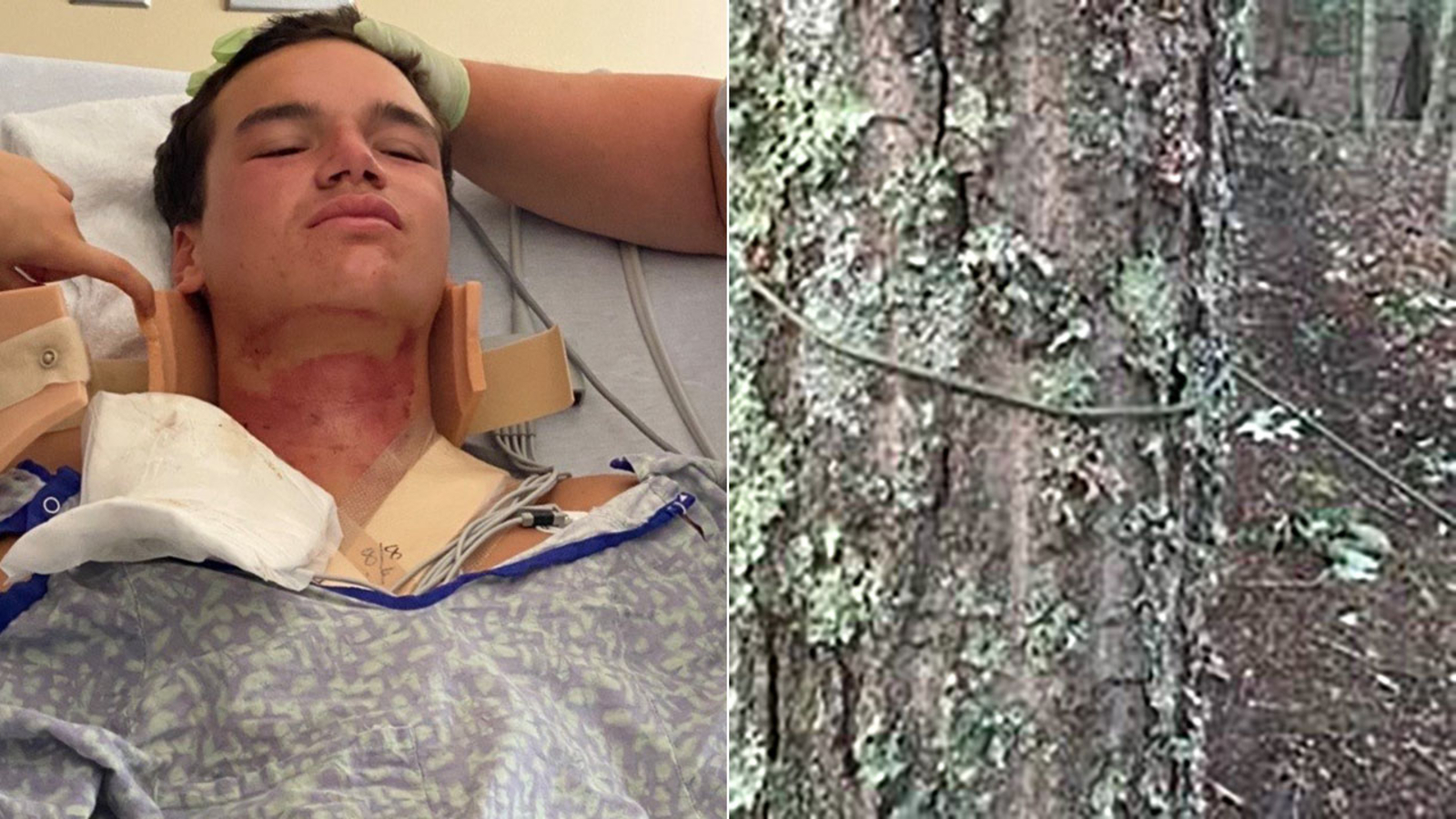 ATV rider seriously injured by parachute cord tied across Sag Harbor ...