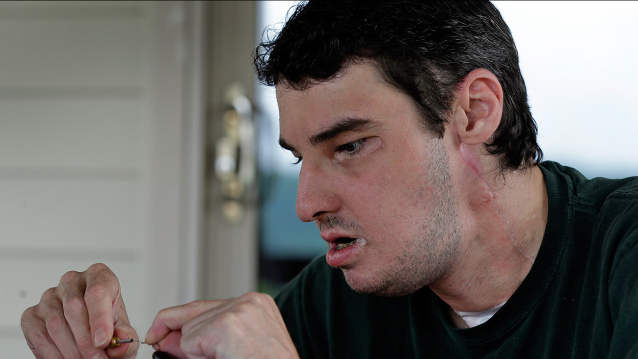 Rebekah Aversano Woman Whose Brother Died In A Road Accident Three Years Ago Reacts After Seeing Her Brother S Transplanted Face On Richard Norris A Man Who Was Severely Disfigured In 1997