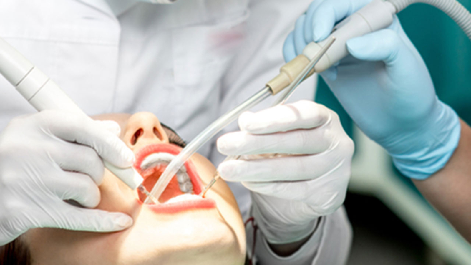 Is your dentist performing oral cancer screenings? ABC13 Houston