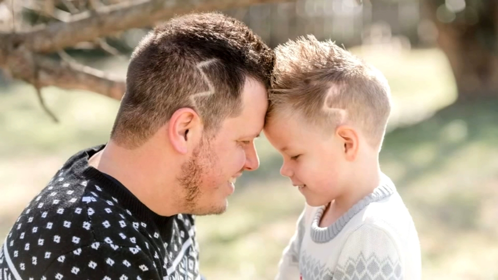 Father gets haircut to match son's scars