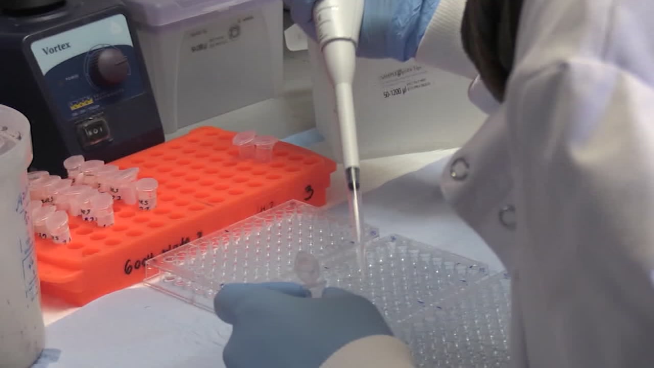 COVID-19 vaccine: Your top 7 questions, answered
