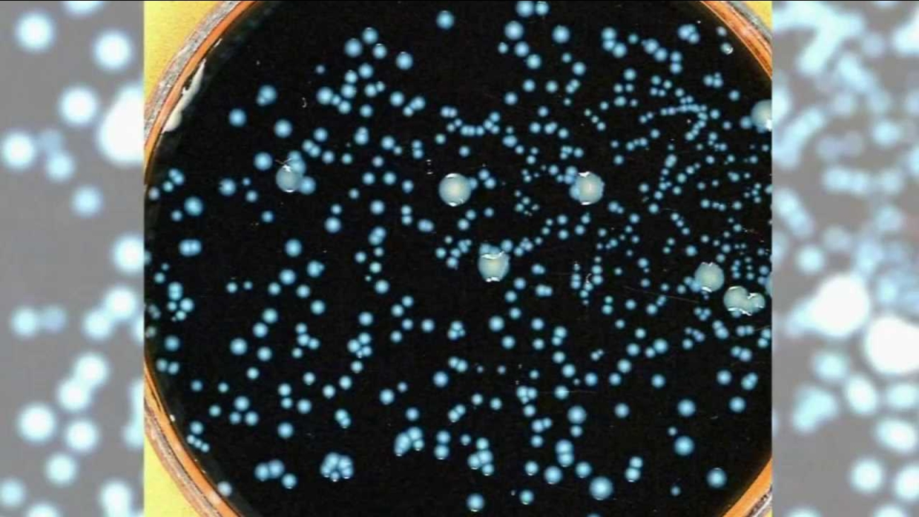 Legionnaires Disease What Is It And What Are The Symptoms