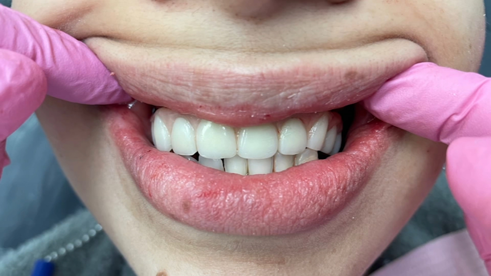 Fresno Mother Of 7 Receives Free Smile Makeover From Dental Professionals Abc30 Fresno