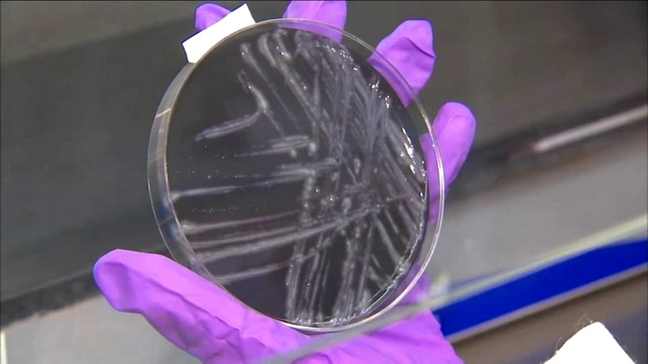 Bacteria that causes Legionnaires' found in water distribution system