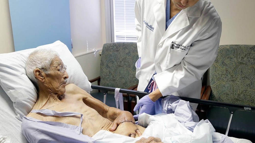 Doctors sew man's hand into his tummy