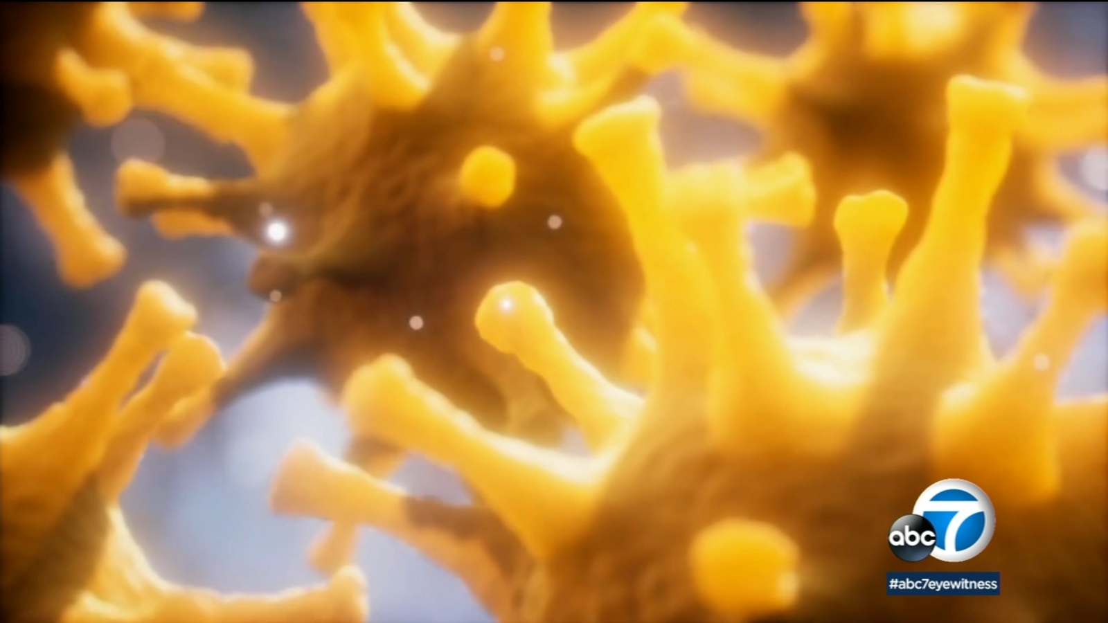 New COVID-19 variant found in more than one-third of Cedars-Sinai patients, new study shows - Vimarsana News